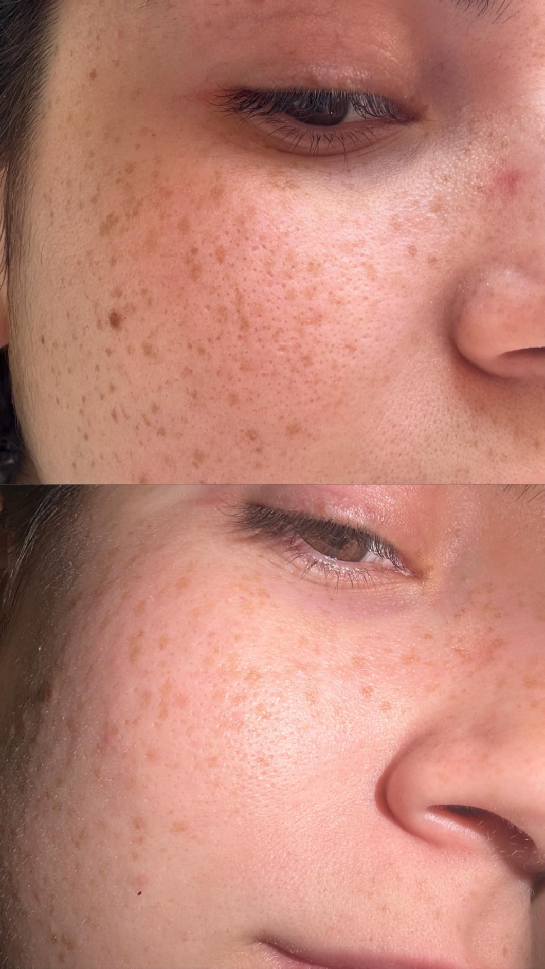 Caudalie Instant Detox Mask Pore Minimizing - Visibly Eliminates Excess Sebum and Visibly Tightens Pores in as Little as 10 Minutes Customer Review Caudalie Instant Detox Mask Pore Minimizing - Visibly Eliminates Excess Sebum and Visibly Tightens Pores in as Little as 10 Minutes - Customer Photo 1