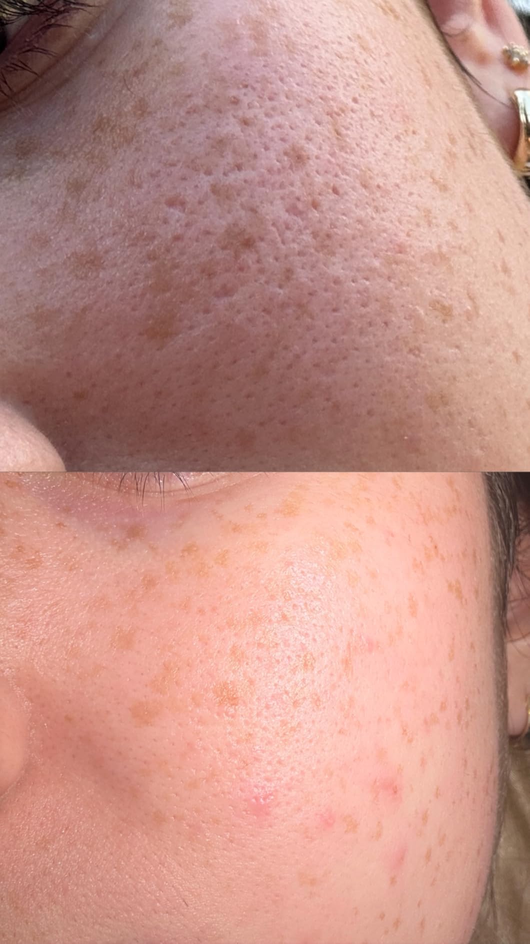 Caudalie Instant Detox Mask Pore Minimizing - Visibly Eliminates Excess Sebum and Visibly Tightens Pores in as Little as 10 Minutes Customer Review Caudalie Instant Detox Mask Pore Minimizing - Visibly Eliminates Excess Sebum and Visibly Tightens Pores in as Little as 10 Minutes - Customer Photo 2
