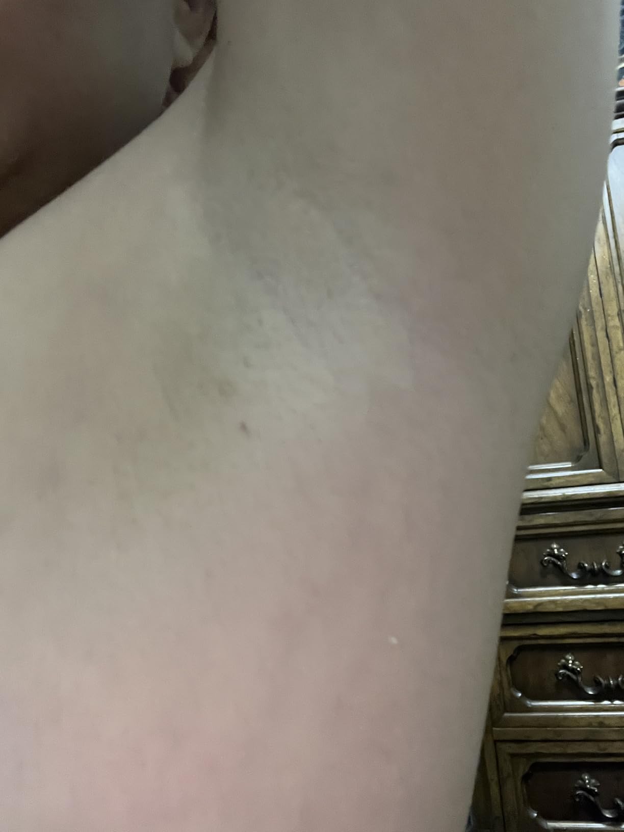 Laser Hair Removal for Women, IPL Laser Hair Removal Device, Painless Hair Remover at Home with Sapphire Ice-Cooling, Long-Lasting Hair Reduction in 3 Weeks for Face Body Bikini, Gifts for Women Her customer photo 1