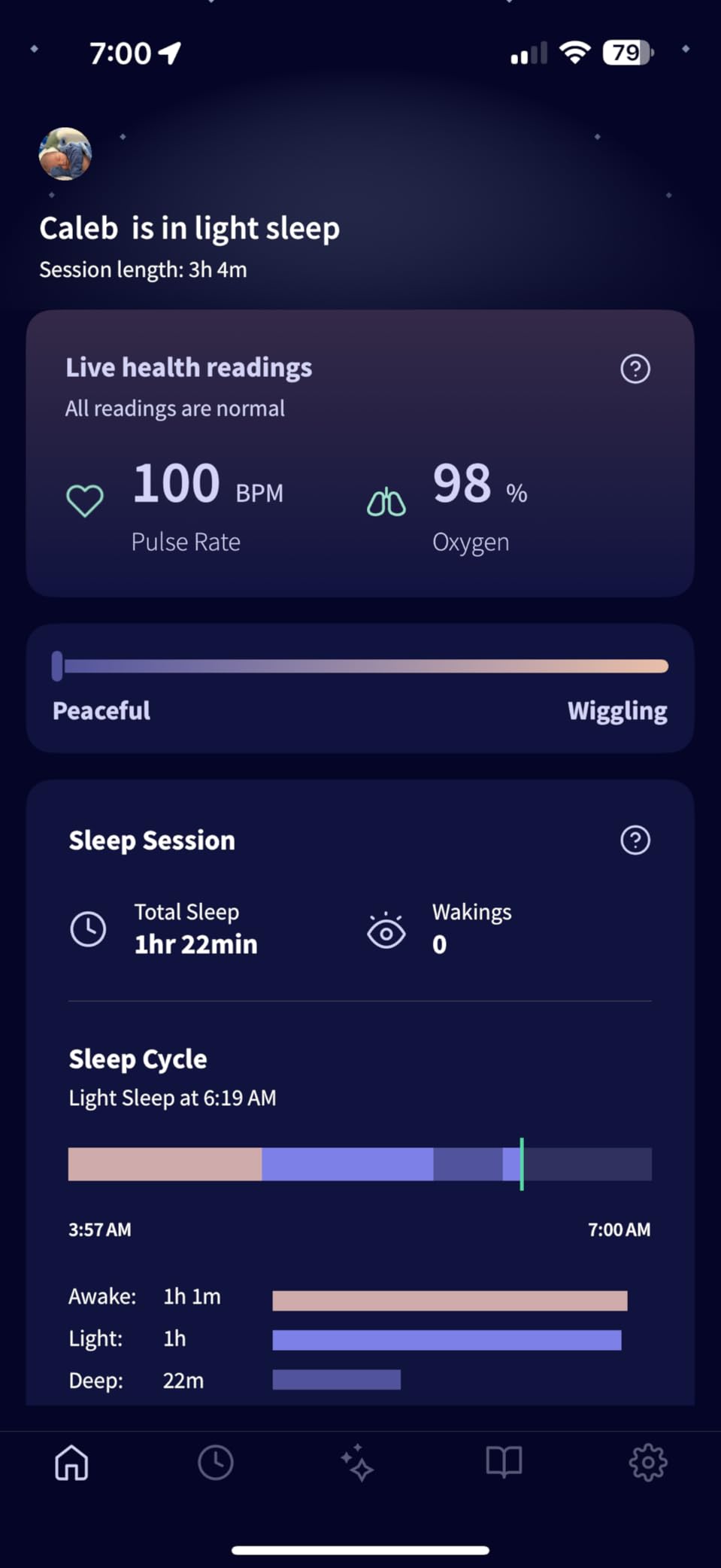 Owlet Dream Sock Smart Wearable Baby Monitor Tracks Heart Rate & Oxygen in Real Time Parents Receive Alerts, Sleep Insights & More via App - Bedtime Blue customer photo 2