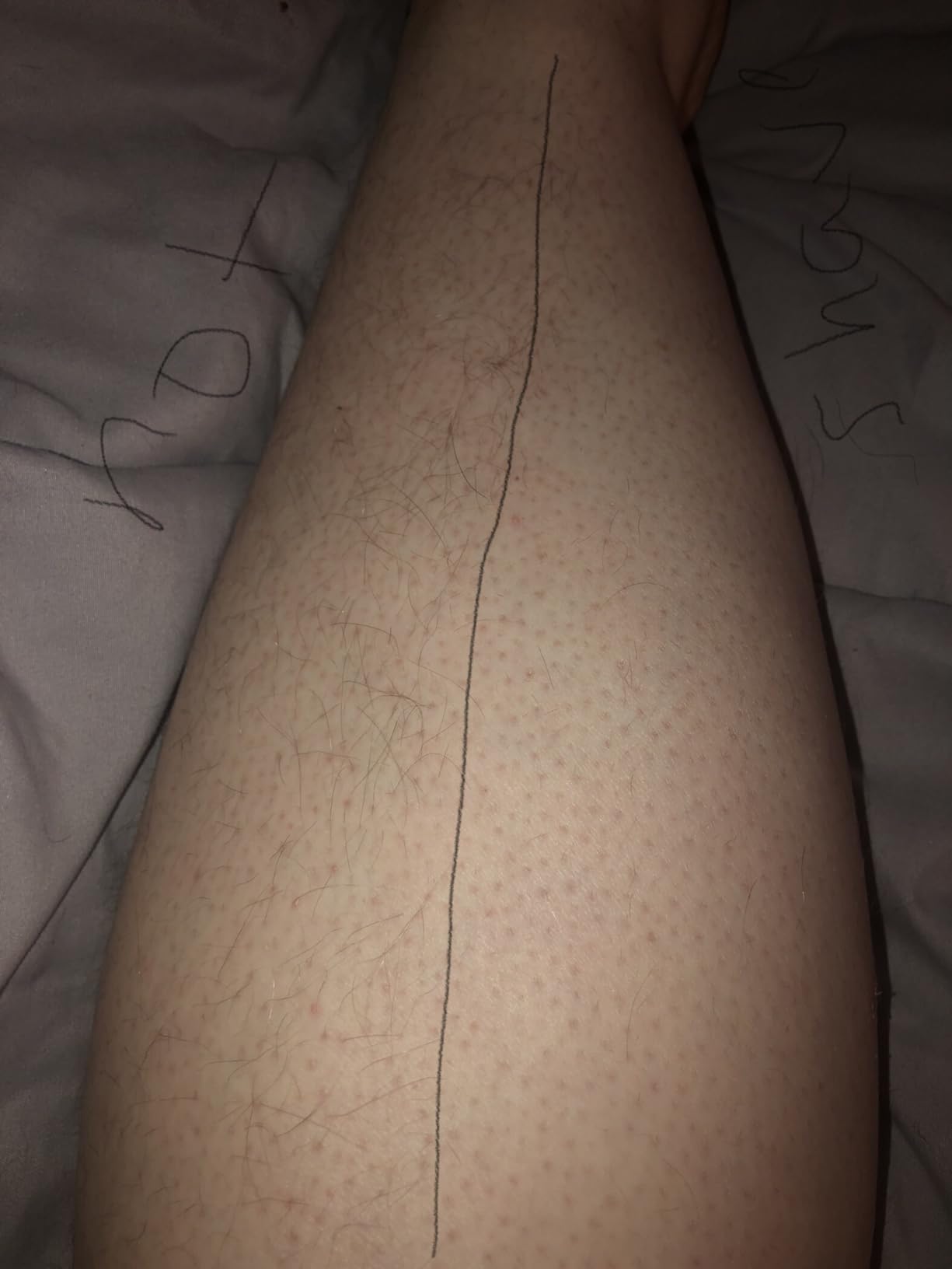 Philips SatinShave Essential Women's Wet & Dry Electric Shaver for Legs & Body, Cordless, with Hypoallergenic Foil, HP6306/50 customer photo 2