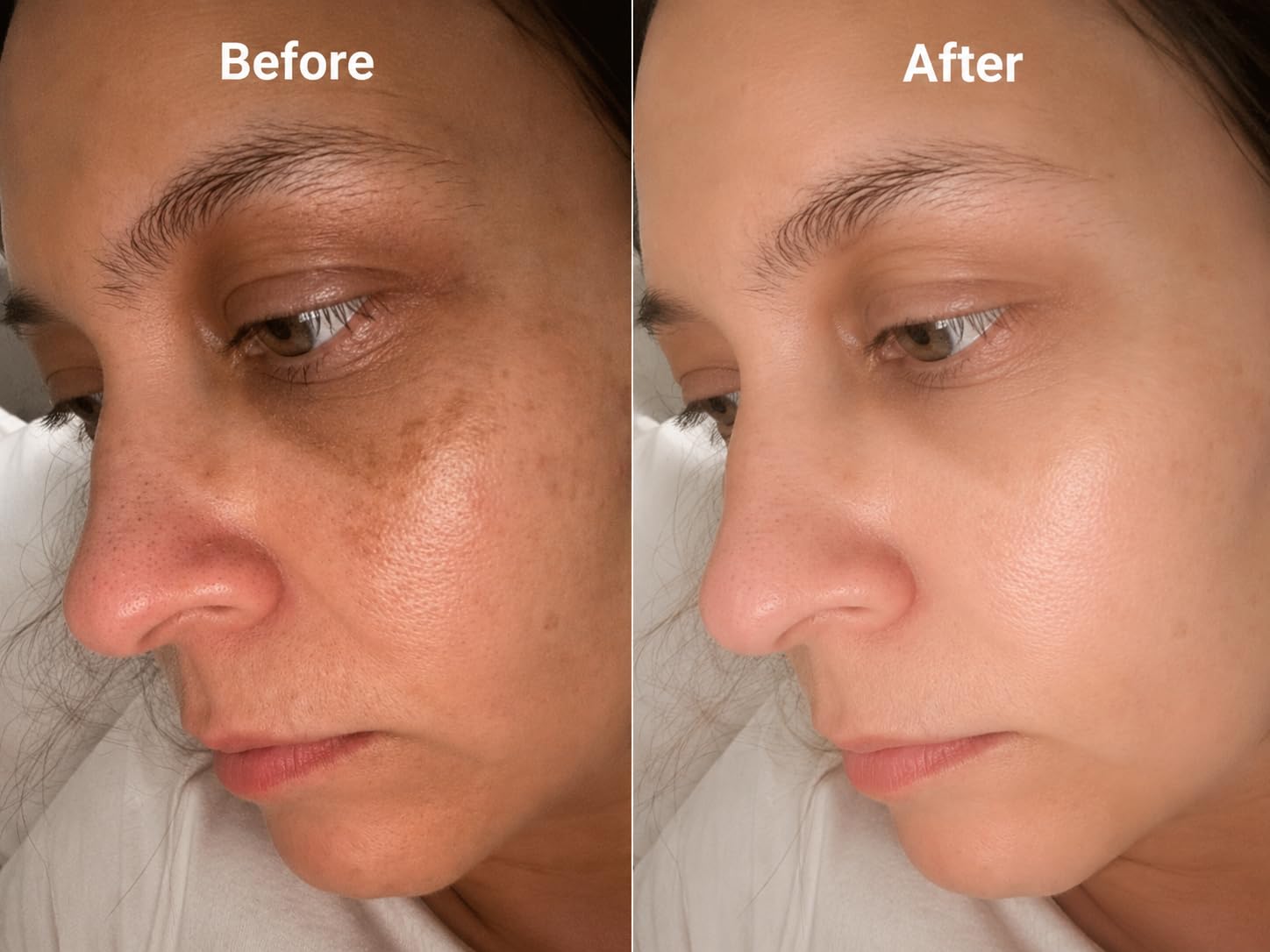 La Roche-Posay Pure 12% Vitamin C Serum For Face With Hyaluronic Acid & Salicylic Acid, Hydrating Face Serum, Boost Radiance & Reduce Wrinkles, 2 Formulas for Normal or Oily Skin Control customer photo 2