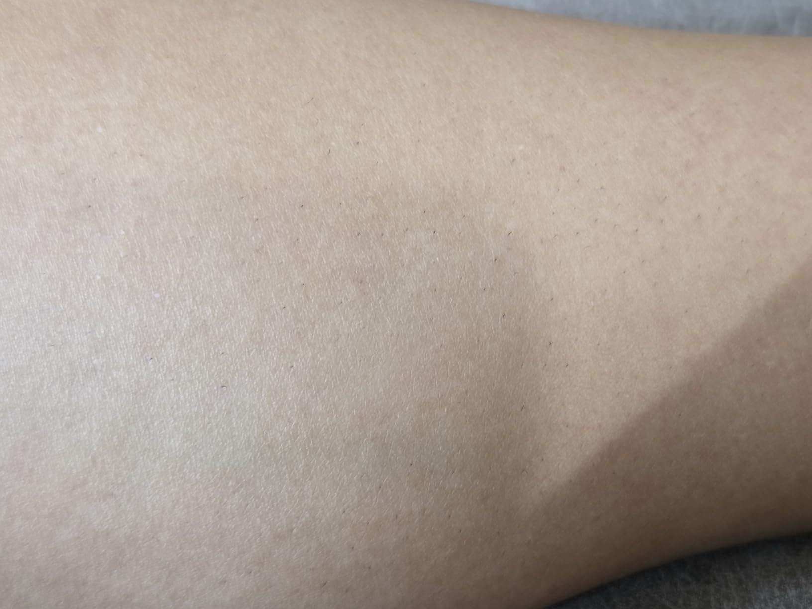 Braun IPL, Silk-Expert Pro 5, IPL Hair Removal for Women and Men, Permanent Laser Hair Reduction At-Home, 2 Heads, Pouch, IPL5137 customer photo 1