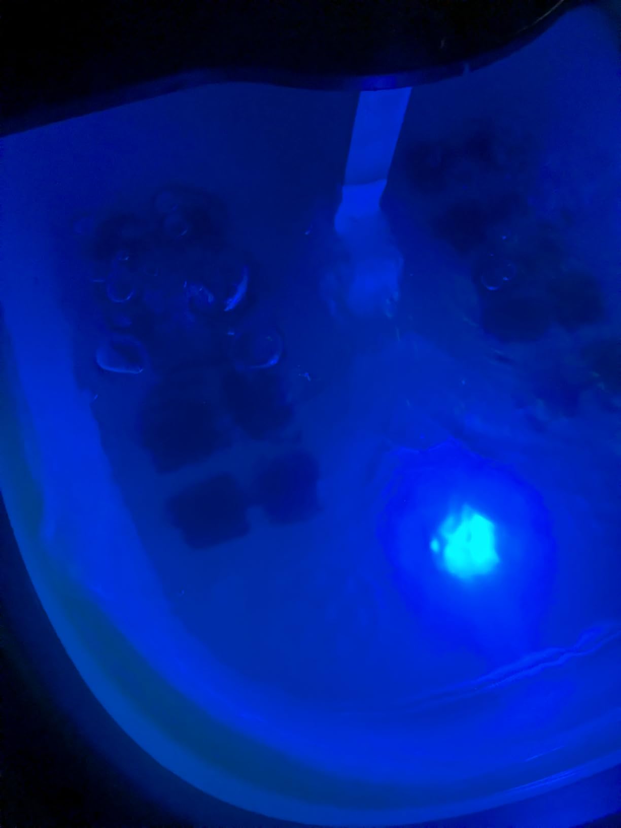 KNQZE Collapsible Foot Spa Electric Foot Bath with Heat, Bubble, Remote, 24 Motorized Shiatsu Massage Balls. Pedicure Soaking tub for Feet Stress Relax customer photo 1